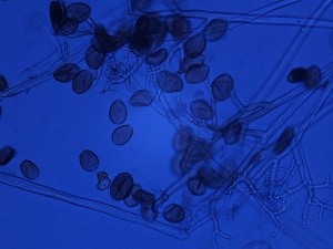 Sporangia and sporangiophores of Pseudoperonospora cubensis under a compound microscope