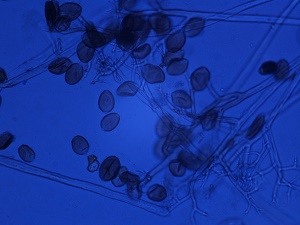 Vue des sporanges et des sporangiophores de Pseudoperonospora cubensis sous un microscope composé